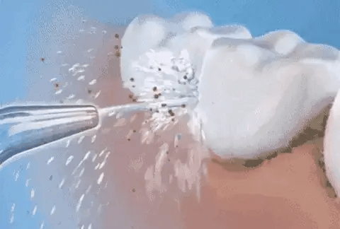 Oralflow Max + Kit De Acessórios Grátis! – Dentes Sempre Limpos