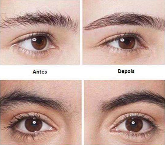 Caneta Depiladora de Sobrancelhas BrowFix - Sobrancelhas Perfeitas Sem Dor