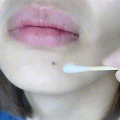 Gel Removedor De Verrugas Trendnatural  – Fim das Verrugas Sem Dor