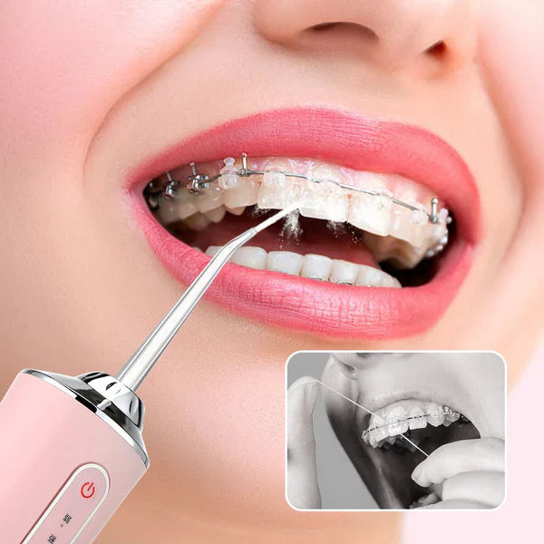 Oralflow Max + Kit De Acessórios Grátis! – Dentes Sempre Limpos