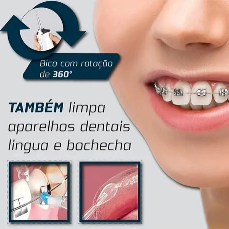 Oralflow Max + Kit De Acessórios Grátis! – Dentes Sempre Limpos